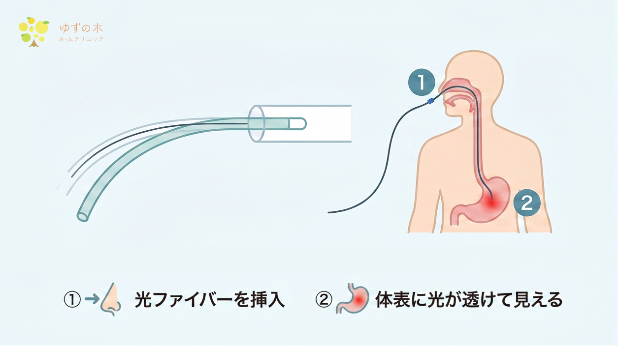 光ファイバーを挿入し体表に光が透けて見える図