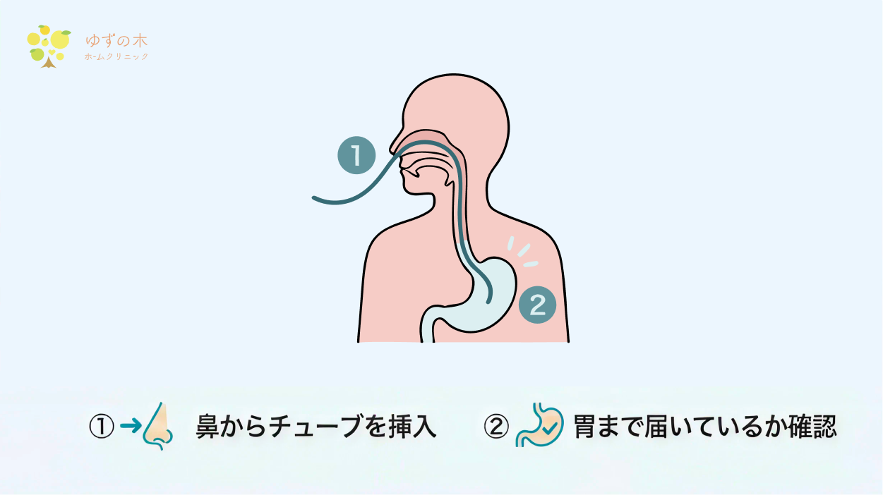 鼻からチューブを挿入し胃まで届いているか確認する図