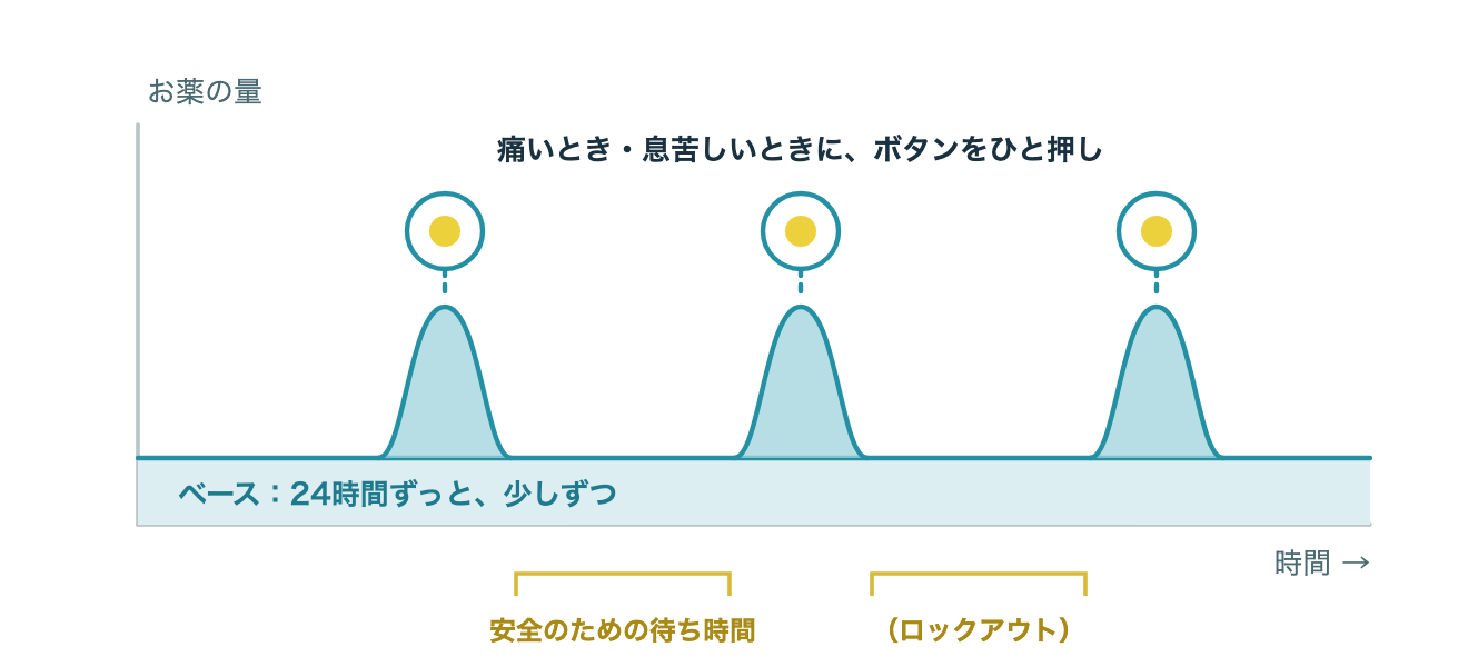 PCA（自己調節鎮痛法）のしくみ：ベースの持続投与に加え、痛いときにボタンを押すと追加投与されます